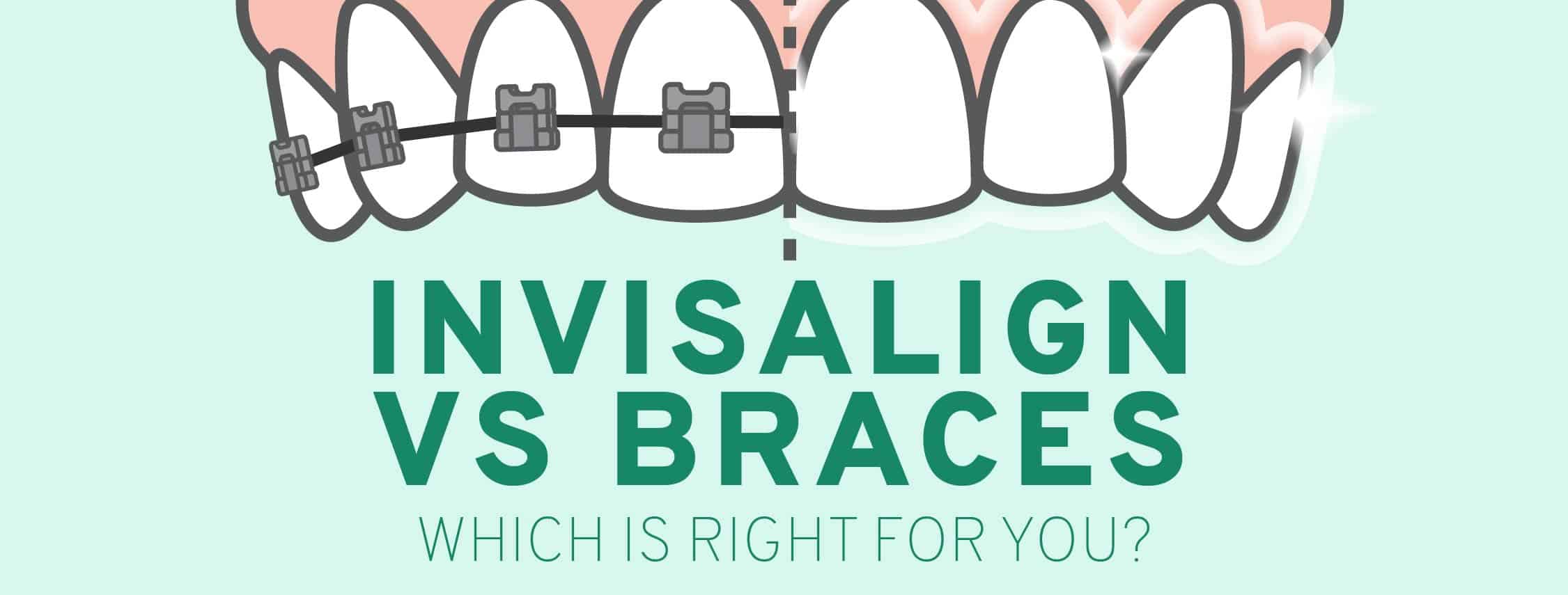 Invisalign vs. Braces: Which One Is Better & Right for You?